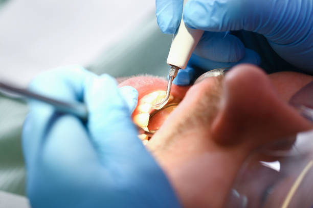 Best Emergency Treatment for Dental Infections or Abscesses in Central City, NE